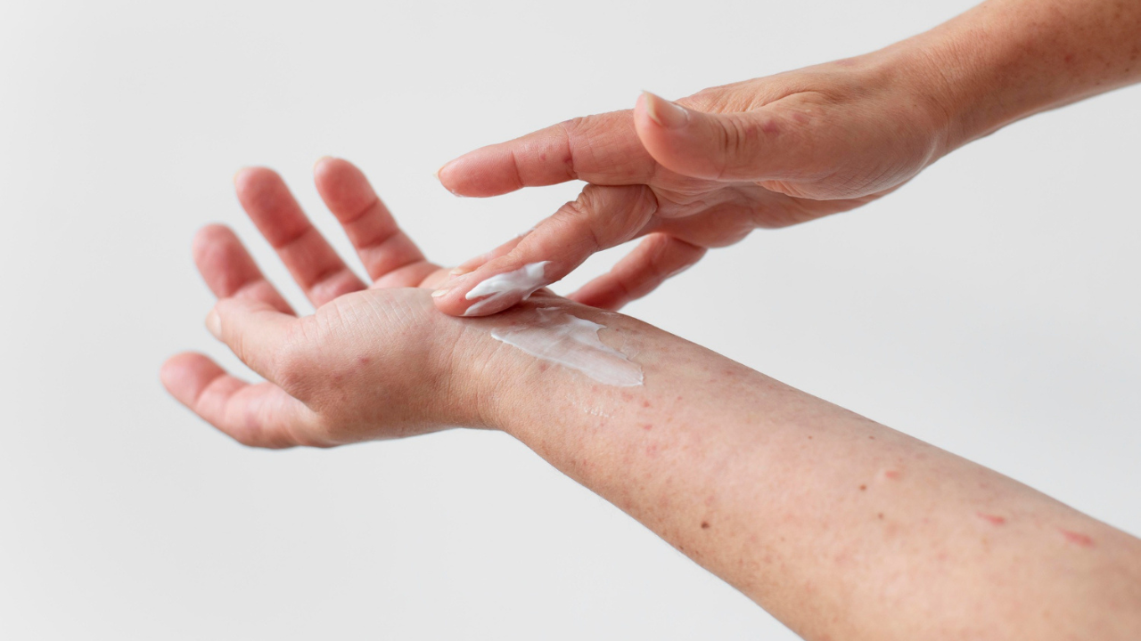 Kulit Badan Kering dan Kusam? Yuk Kenali Penyebab dan Solusi Glowing Kembali