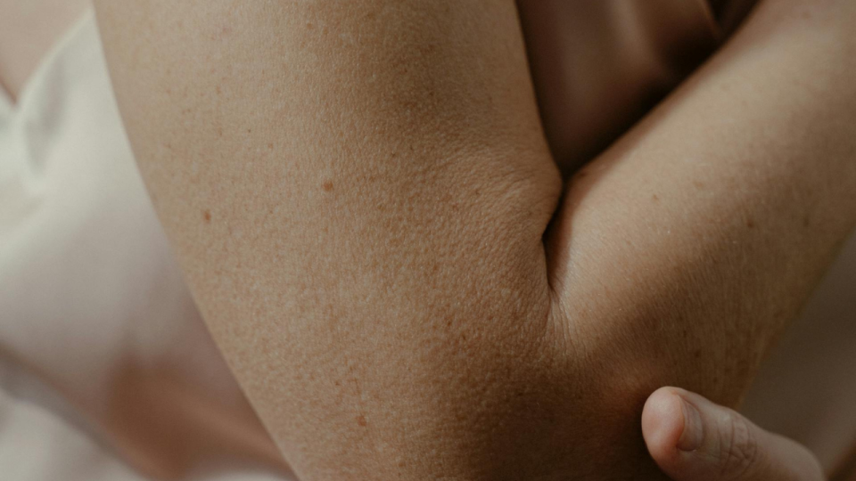 Menjaga Kelembapan Kulit dengan Body Lotion untuk Kulit Tetap Sehat