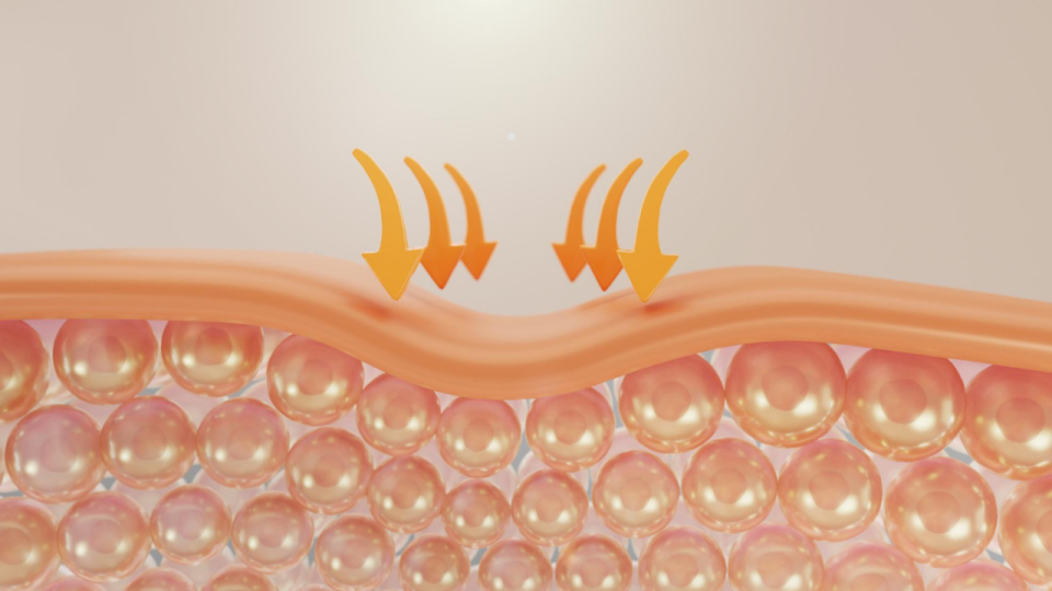 Apa Itu Skin Barrier?