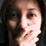 Apa yang Terjadi Jika Skin Barrier Terganggu?