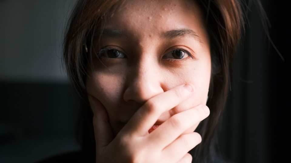 Apa yang Terjadi Jika Skin Barrier Terganggu?