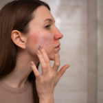 Tanda Sepele Skin Barrier Rusak yang Sering Tidak Disadari