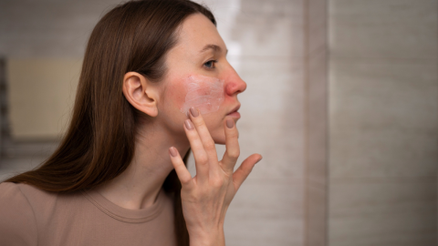 Tanda Sepele Skin Barrier Rusak yang Sering Tidak Disadari