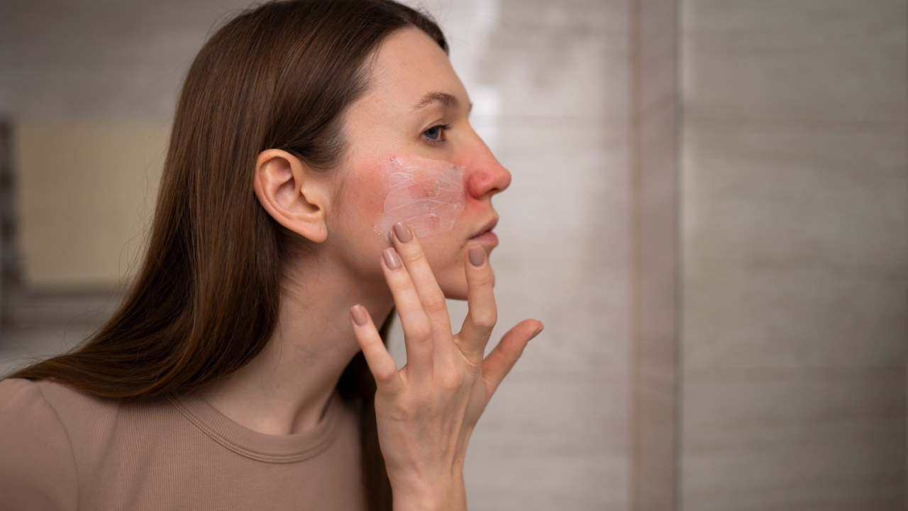 Tanda Sepele Skin Barrier Rusak yang Sering Tidak Disadari