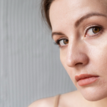 Kenapa Kulit Terlihat Kusam Padahal Sudah Pakai Skincare?